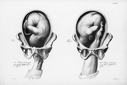 Midwifery Illustrated, click for larger image