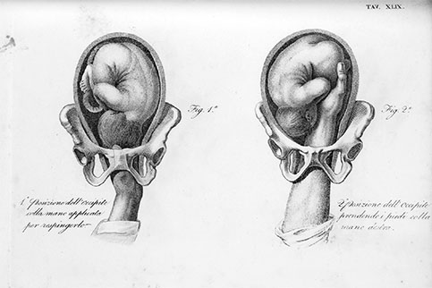 Midwifery Illustrated, click for larger image