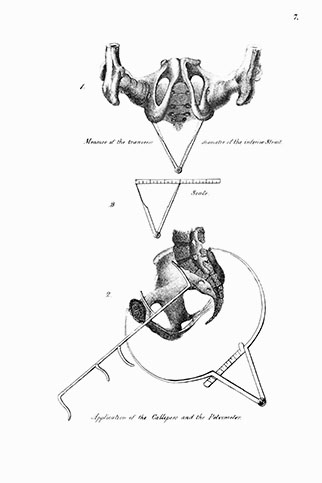 Midwifery Illustrated, click for larger image